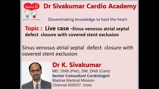 22 Live case Sinus venosus atrial septal defect closure with covered stent exclusion [upl. by Bernj]