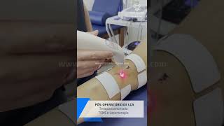 Pósoperatório do Ligamento Cruzado Anterior  Terapia Combinada TENS e Laserterapia [upl. by Seavir]