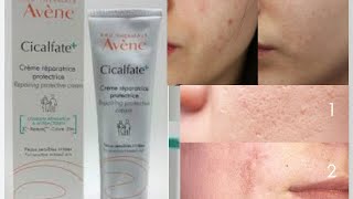 avène cicalfate أفضل كريم مرمم كيعالج تهيج البشرة والحروق السطحية والحبوب واثارها وليساكتريس [upl. by Attoynek890]