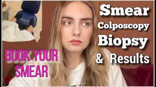 SMEAR STORY COLPOSCOPY BIOPSY amp RESULTS  WHAT I WISH I HAD BEEN TOLD [upl. by Richel]