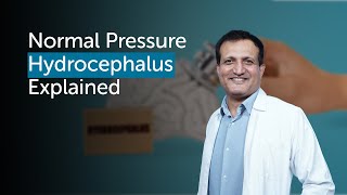 Understanding Normal Pressure Hydrocephalus Symptoms Diagnosis amp Treatment  Gleneagles Hospital [upl. by Caprice]