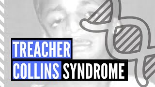 TreacherCollins Syndrome  Pathology Diagnosis Clinical Presentation and Treatment [upl. by Viridissa]