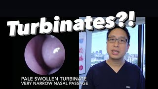 Inferior Turbinates what are they why do they swell stuffy nose congestion how do we treat [upl. by Assiruam]