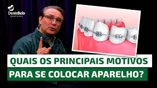 Quais os principais motivos para se colocar aparelho dentário  DenteBelo [upl. by Druci670]