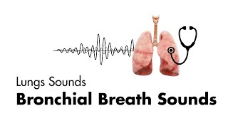 Bronchial Breath Sounds  Lung Sounds  Medzcool [upl. by Saticilef]