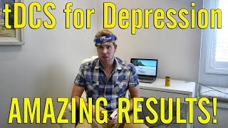 tDCS Treatment for Depression  Amazing Results [upl. by Zola]