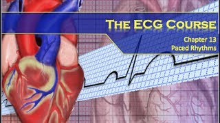 The ECG Course  Paced Rhythms [upl. by Rasia796]