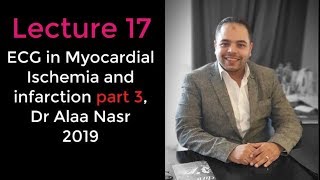 ECG from A to Z 017Alaa nasr2019 Myocardial ischemia part 3 [upl. by Attenyl693]