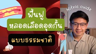 ฟื้นฟูหลอดเลือดแข็ง ด้วยธรรมชาติบำบัด  หมอนัท Live [upl. by Naired]