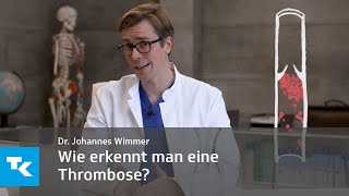 Wie erkennt man eine Thrombose  Dr Johannes Wimmer [upl. by Nylecsoj]