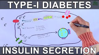 Type I Diabetes Mellitus  Mechanism [upl. by Atteuqihc426]