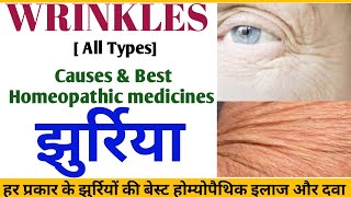 Homoeopathic Medicines For WrinklesJhuriyon Ka ilajFace Wrinkles Fine Linesझुर्रियांin Hindi [upl. by Ahtenak]