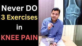 Never Do 3 Exercises in Knee Pain Knee osteoarthritis Patellofemoral Syndrome Knee Pain Treatment [upl. by Annavoj]