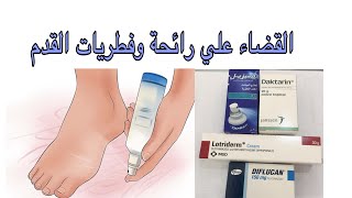 التخلص من رائحة القدم الكريهة والفطريات [upl. by Aisiram259]