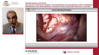 WebinarNeurocirurgia VascularUso de Clips Yasargil no Tratamento de Aneurerismas e MAV’s Cerebrais [upl. by Archaimbaud]