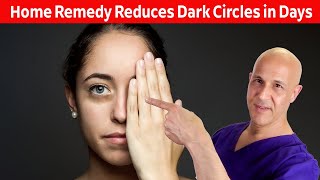 Home Remedy Reduces Dark Eye CirclesResults in Days Dr Mandell [upl. by Flavio481]