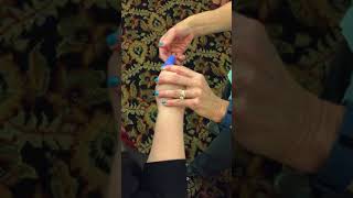 Serial Splinting for Finger Contractures [upl. by Yerfej]