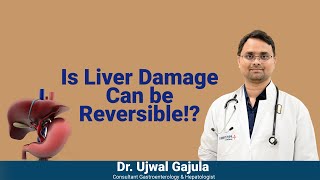 Chronic Liver Disease be cured  Liver Damages can be Reversible  Dr Ujwal Gastroenterologist [upl. by Curren]