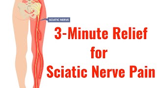 3 of the Best Exercises for Relief of Sciatic Nerve Pain With FREE Exercise Sheet [upl. by Githens]