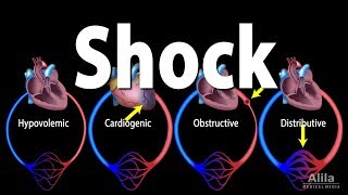 Shock Pathology of Different Types Animation [upl. by Herwick]