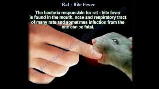 Rat Bite Fever  Everything You Need To Know  Dr Nabil Ebraheim [upl. by Alletneuq688]