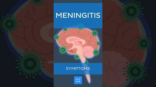 Meningitis Symptoms  Kenhub meningitis [upl. by Ahsuatal661]