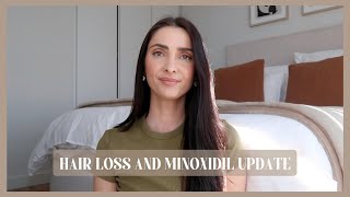 HAIR LOSS UPDATE  my hair loss and minoxidil update my minoxidil experience androgenic alopecia [upl. by Kussell]