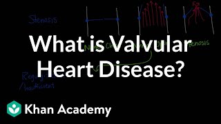 What is valvular heart disease  Circulatory System and Disease  NCLEXRN  Khan Academy [upl. by Lener]