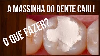 A quotMASSINHAquot  CURATIVO do dente caiu O QUE FAZER [upl. by Hayila678]