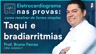 Taqui e bradiarritmias  Eletrocardiograma [upl. by Amaerd]