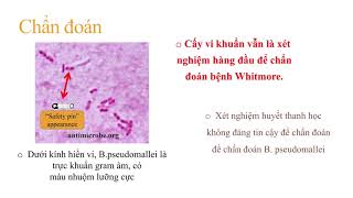 Bệnh Whitmore  Melioidosis  Burkholderia pseudomallei [upl. by Eversole]