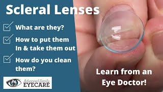 Scleral Lenses What They Are amp How to Use Them [upl. by Eisdnyl]