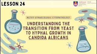 Understanding The Transition From Yeast To Hyphal Growth In Candida Albicans [upl. by Eula]