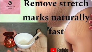 stretch mark removal homemade natural cream  natural ingredients  Skin care [upl. by Talia]