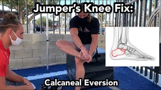 Jumper’s Knee Calcaneal Eversion Fix Patellar Tendon Pain [upl. by Jestude]