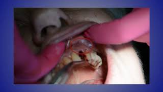 Case of the Week Immediate Extraction and Implant Placement [upl. by Rothberg]