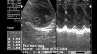 ECOGRAFIA VETERINARIA  ENFERMEDAD VALVULAR MITRAL [upl. by Yendyc806]