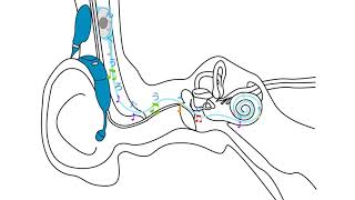 人工内耳 聞こえの仕組み（アドバンスト・バイオニクス） [upl. by Aiynot172]