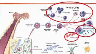 Aplastic Anemia Approach on Diagnosis and Treatment Options 2018 [upl. by Atiuqat]