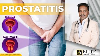 Prostatitis Treatment at EliteAyurveda  Treat Naturally with Herbal Ayurveda [upl. by Aretina]