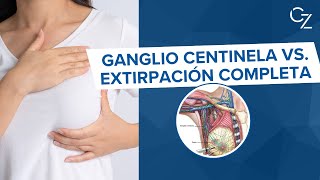 Ganglio Centinela vs Extirpación Completa [upl. by Laaspere]