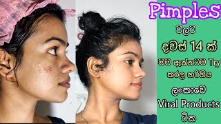 දවස් 14න් Pimples අඩු කරන්න මම Use කරපු නිශ්පාදන How I got Rid of Pimples  Pimples Remove at home [upl. by Eolcin988]