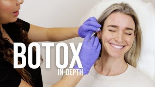 BOTOX  INDEPTH [upl. by Nothgierc]