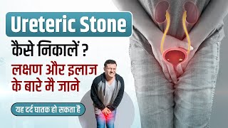 Ureteric Stone in Hindi  Symptoms ManagementTreatment Pain xrays  Ureteric Stone kaise nikale [upl. by Itsym]