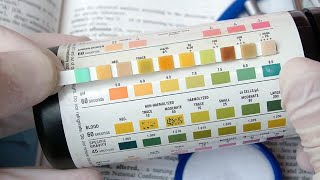 Introduction to General Urine Examination Urinalysis فحص الادرار العام [upl. by Wons]