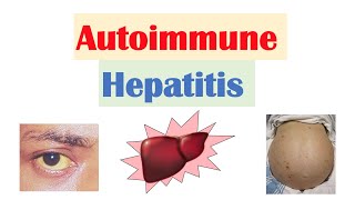 Autoimmune Hepatitis  Pathogenesis Signs amp Symptoms Diagnosis Treatment [upl. by Binny876]