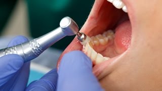 Antibiotic premedication for patients undergoing dental procedures [upl. by Belldame717]