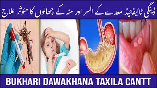 Dengue Typhoid Maiday ke Ulcer aur Munh ke Chhalon ka Moasar Ilaj  Best Treatment [upl. by Nyleaj]