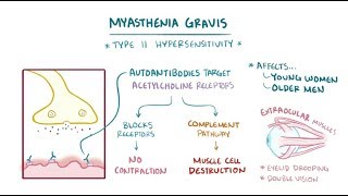 Myasthenia gravis [upl. by Els]