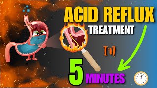 Effective Home Remedies For Acid Reflux  Natural Treatment At Home [upl. by Lekym]